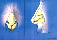 Rinoplastia - Cirugia de la Nariz - Dr. Joaquim Suñol - Cirugia Plastica Estetica